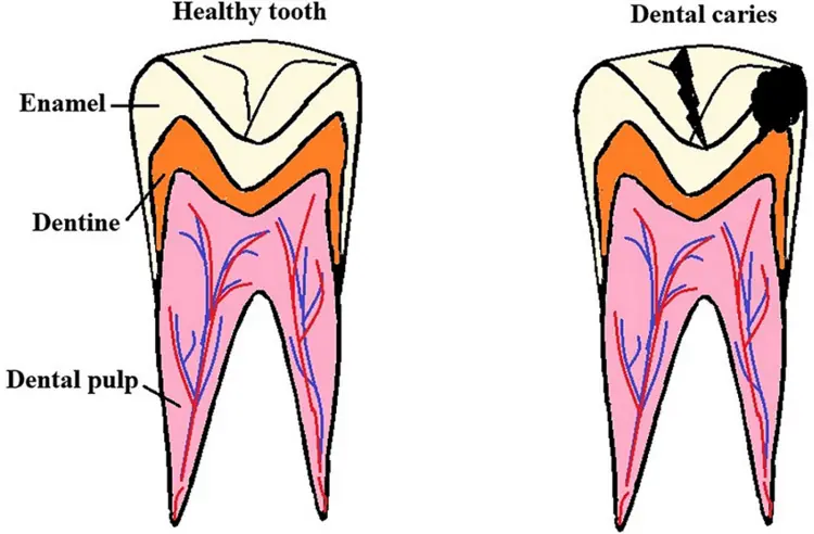 galla chinensis for teeth galla chinensis for teeth